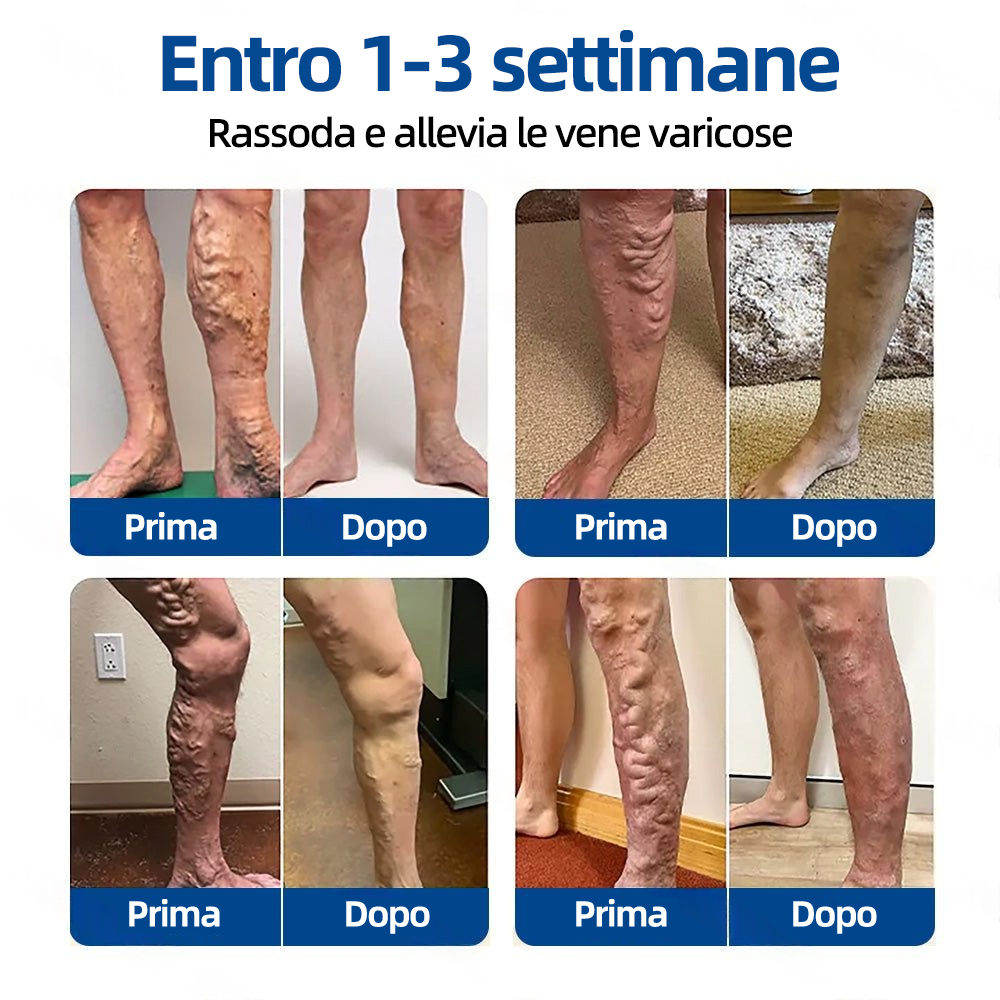 🇮🇹👨‍⚕️👍✅ Healrize® VeinTarget Patch Microneedle 🎖️ Sollievo Immediato, Risultati a Lungo Termine 🎖️