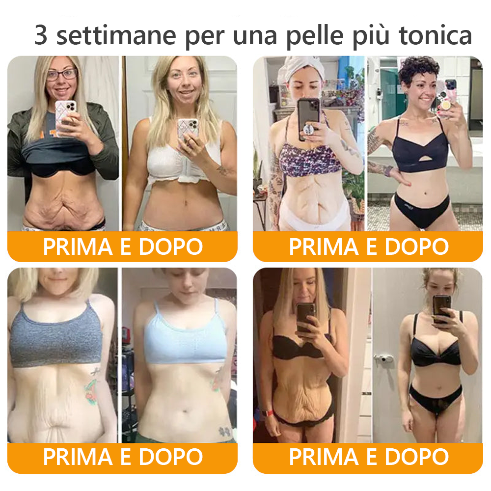 Prodotto e spedito dall'Italia✅ AWZLOVE® Crema completa al veleno d'api 🐝ULTIMO GIORNO 80% DI SCONTO🐝