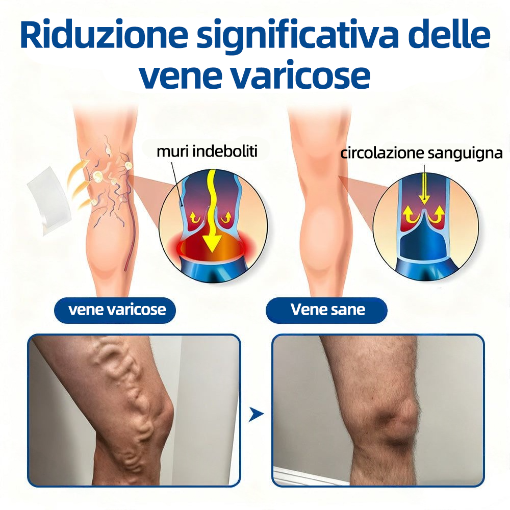 🇮🇹👨‍⚕️👍✅ Healrize® VeinTarget Patch Microneedle 🎖️ Sollievo Immediato, Risultati a Lungo Termine 🎖️