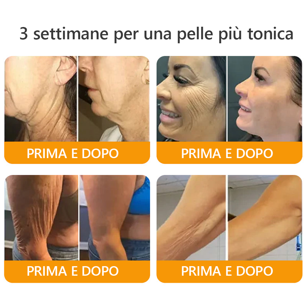 Prodotto e spedito dall'Italia✅ AWZLOVE® Crema completa al veleno d'api 🐝ULTIMO GIORNO 80% DI SCONTO🐝